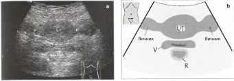 : http://euromedcompany.ru/images/articles/book12/img590.jpg