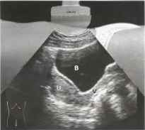: http://euromedcompany.ru/images/articles/book12/img41.jpg
