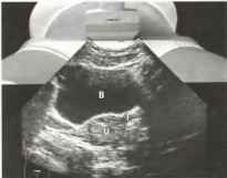 : http://euromedcompany.ru/images/articles/book12/img40.jpg