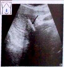 : http://euromedcompany.ru/images/articles/book17/img913.jpg