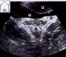 : http://euromedcompany.ru/images/articles/book17/img912.jpg